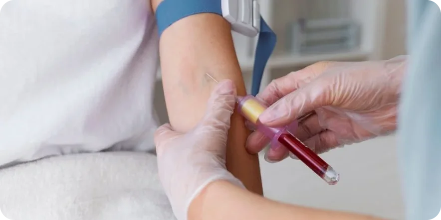 Gıda İntolerans Paneli