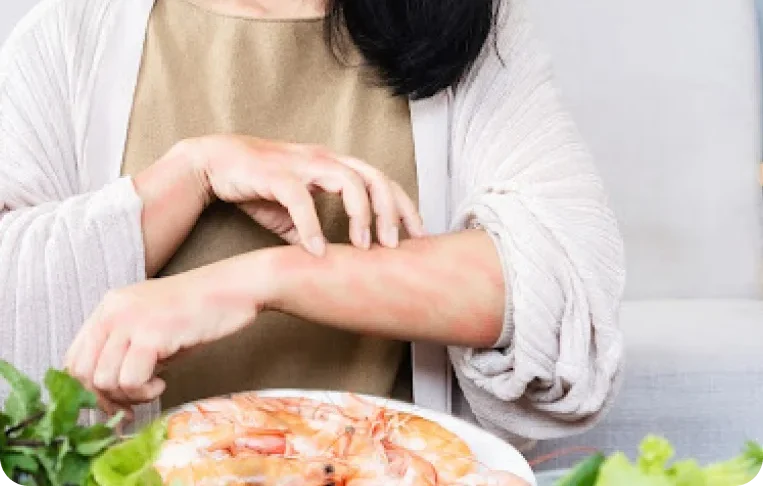 Gıda İntolerans Paneli