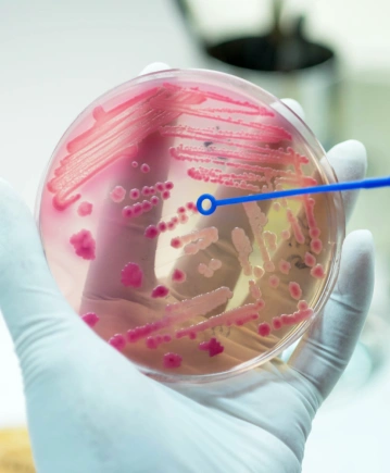 Mikrobiyoloji Testleri