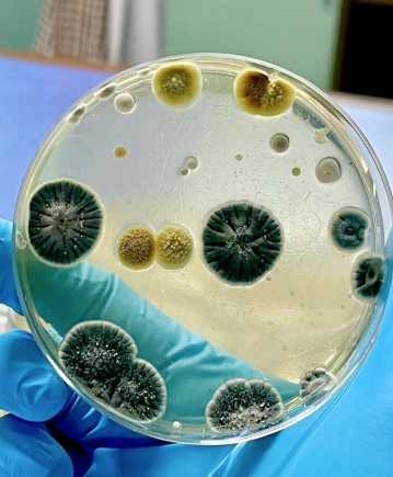 Mikrobiyoloji Testleri