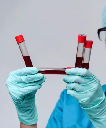 Toksikoloji Testleri