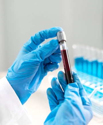 Koagülasyon Testleri