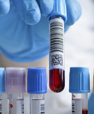 Koagülasyon Testleri