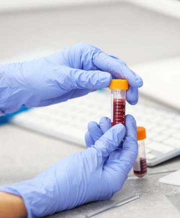 Koagülasyon Testleri