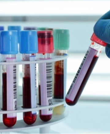 İmmünoloji Testleri