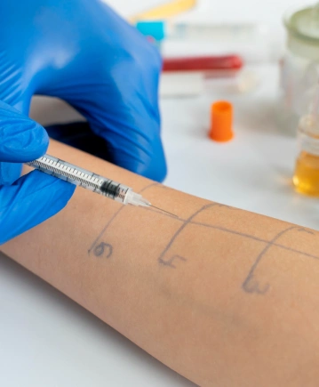 İmmünoloji Testleri