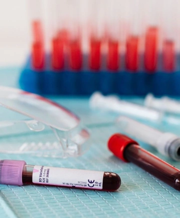 İmmünoloji Testleri