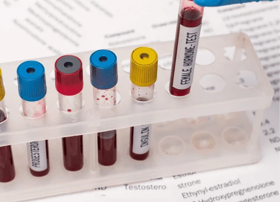 Tıbbi Laboratuvar Hizmetleri