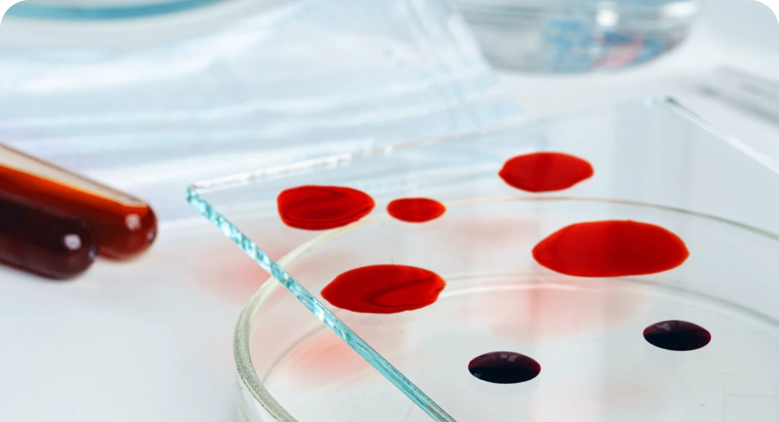 Anemi (Kansızlık) Paneli