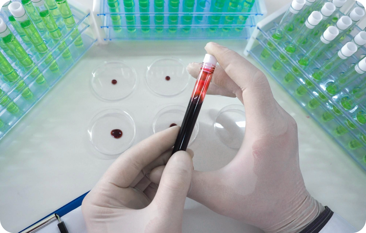 Koagülasyon Testleri