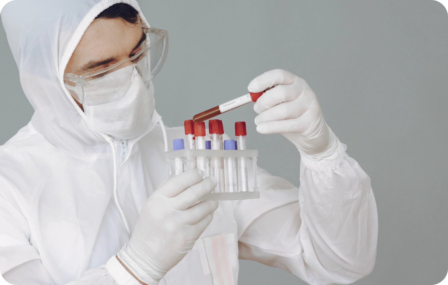 Koagülasyon Testleri