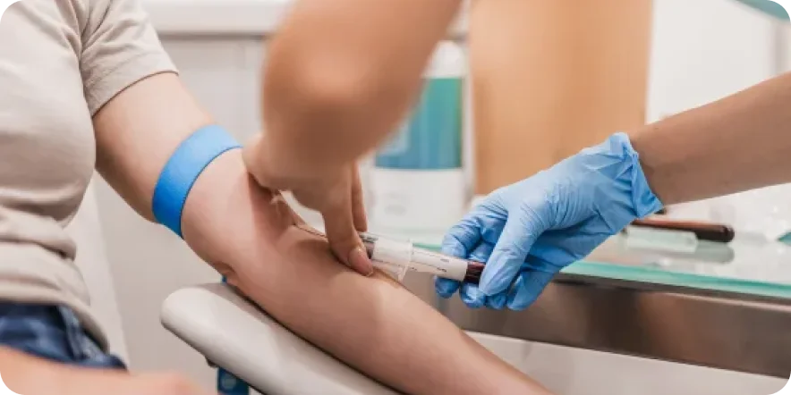 Kalp Hastalıkları Risk Paneli