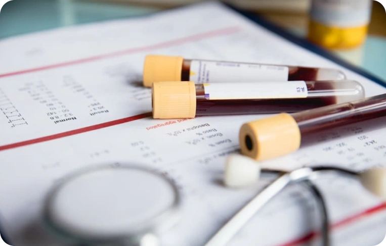 Koagülasyon Testleri