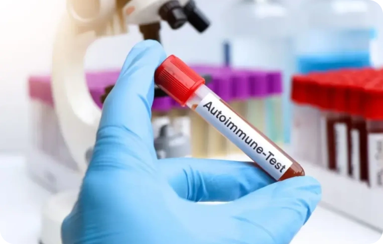 İmmünoloji Testleri