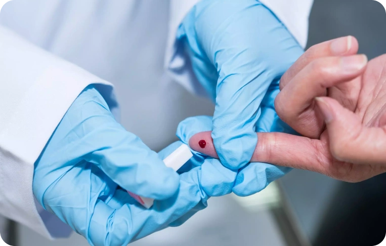 İmmünoloji Testleri