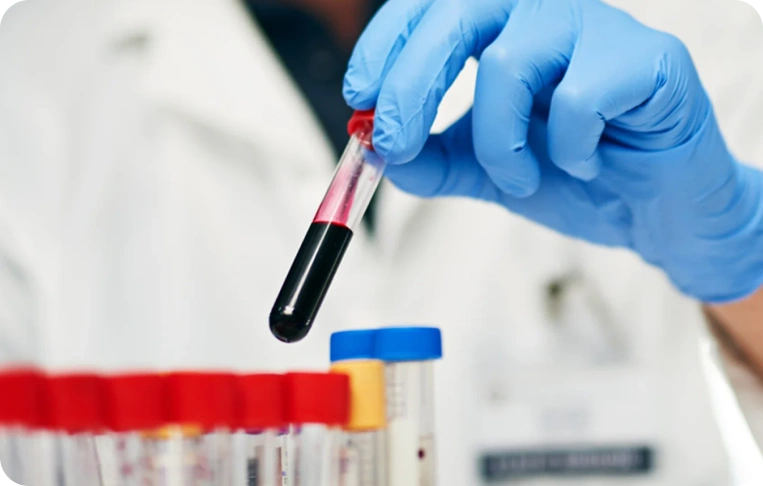 Koagülasyon Testleri