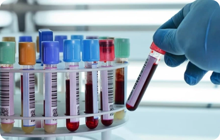 Toksikoloji Testleri