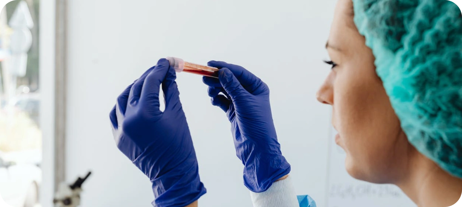 Koagülasyon Testleri