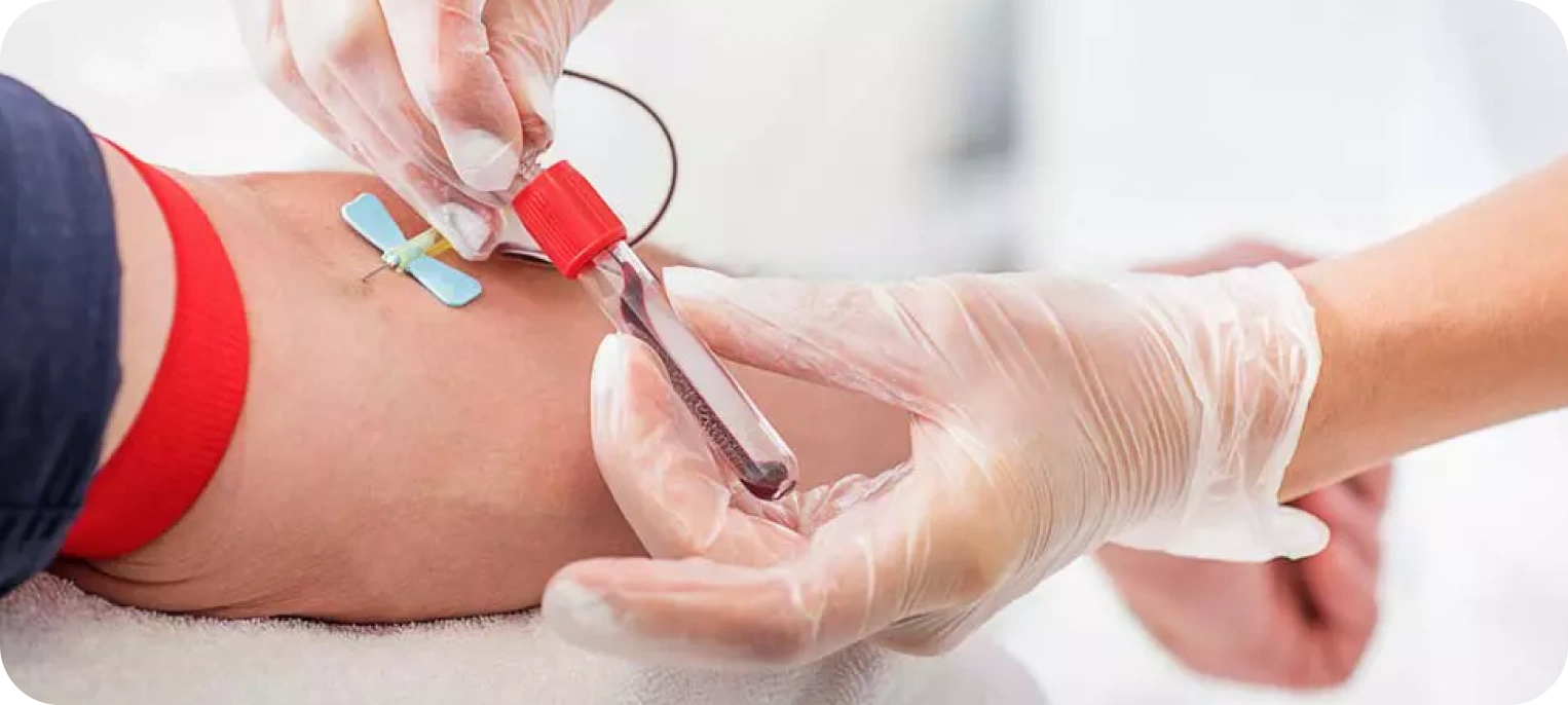 İmmünoloji Testleri