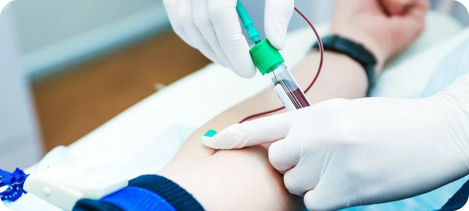 İmmünoloji Testleri