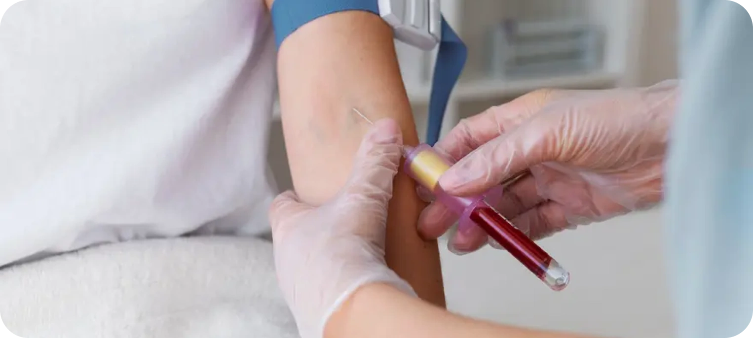 Koagülasyon Testleri