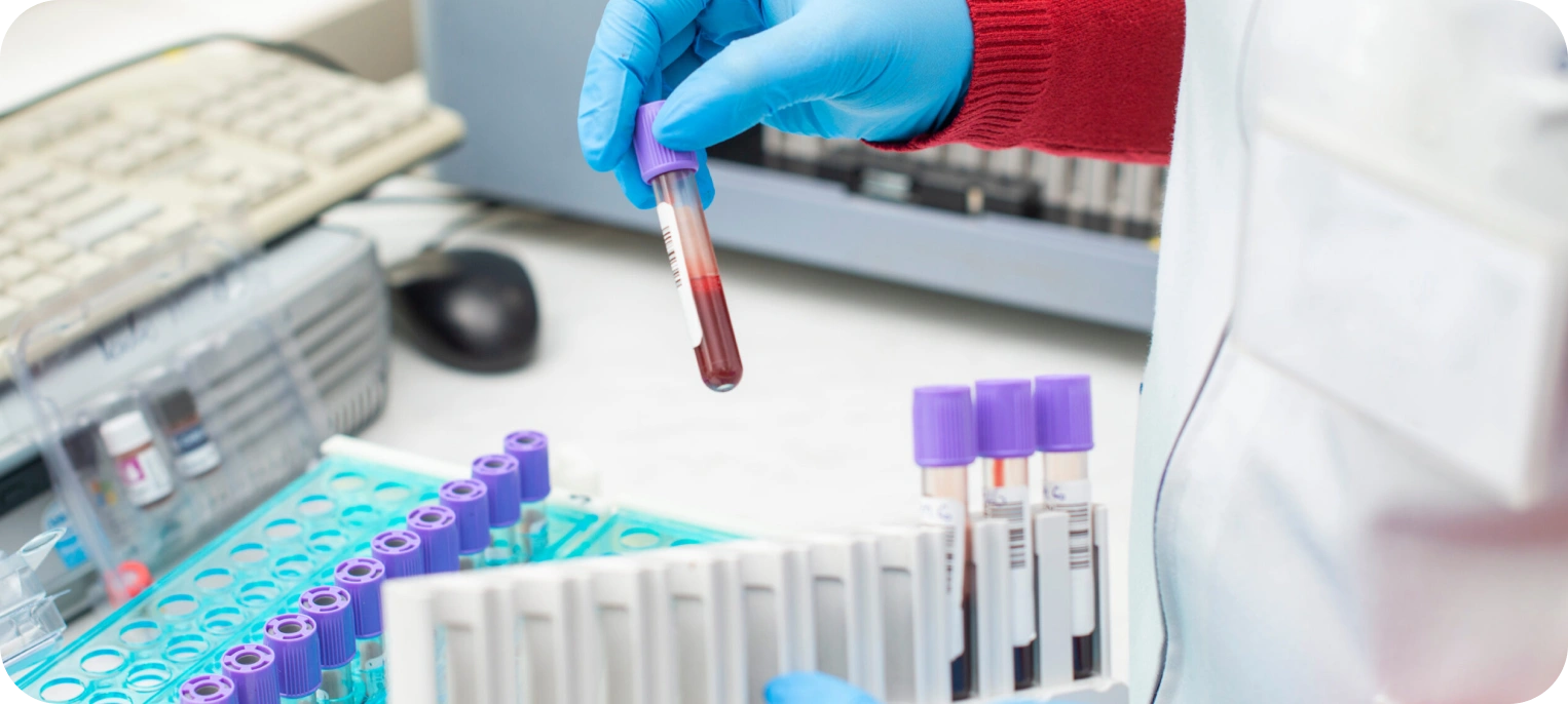 Toksikoloji Testleri