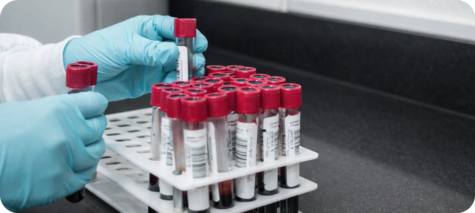 İmmünoloji Testleri