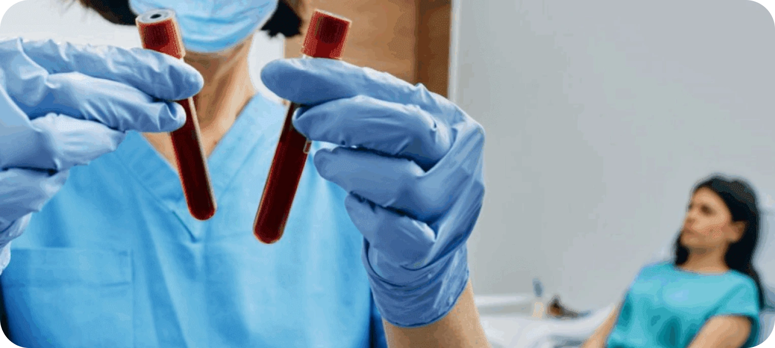 İmmünoloji Testleri