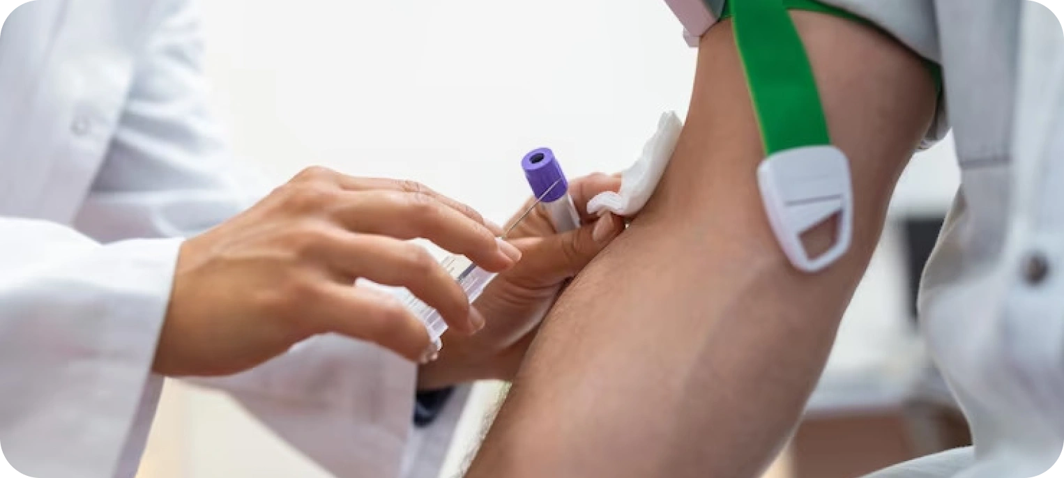 Mikrobiyoloji Testleri