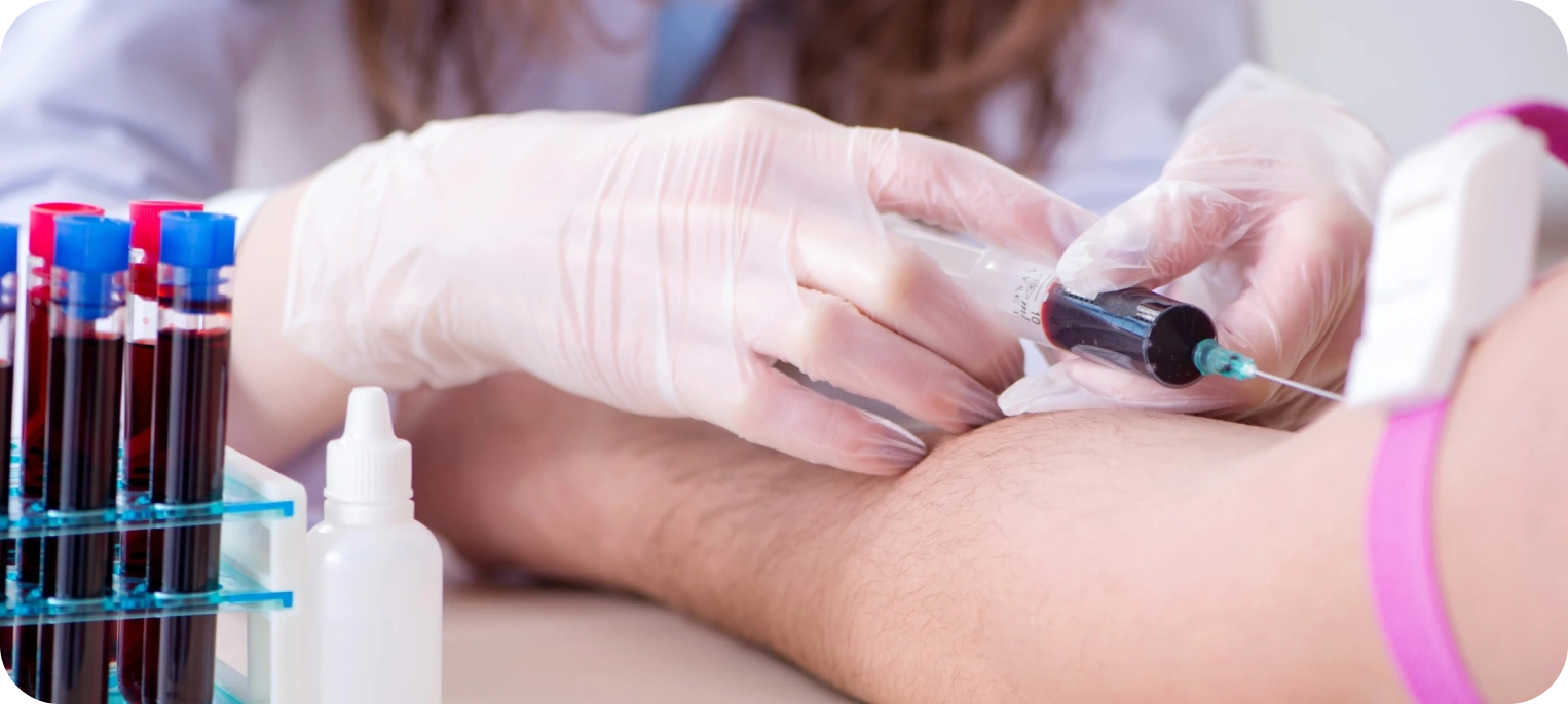 Koagülasyon Testleri