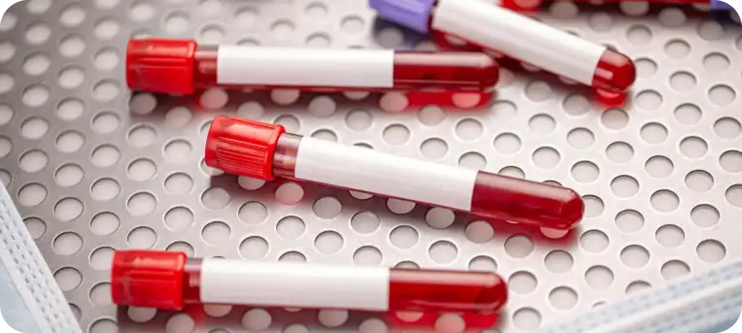 Toksikoloji Testleri