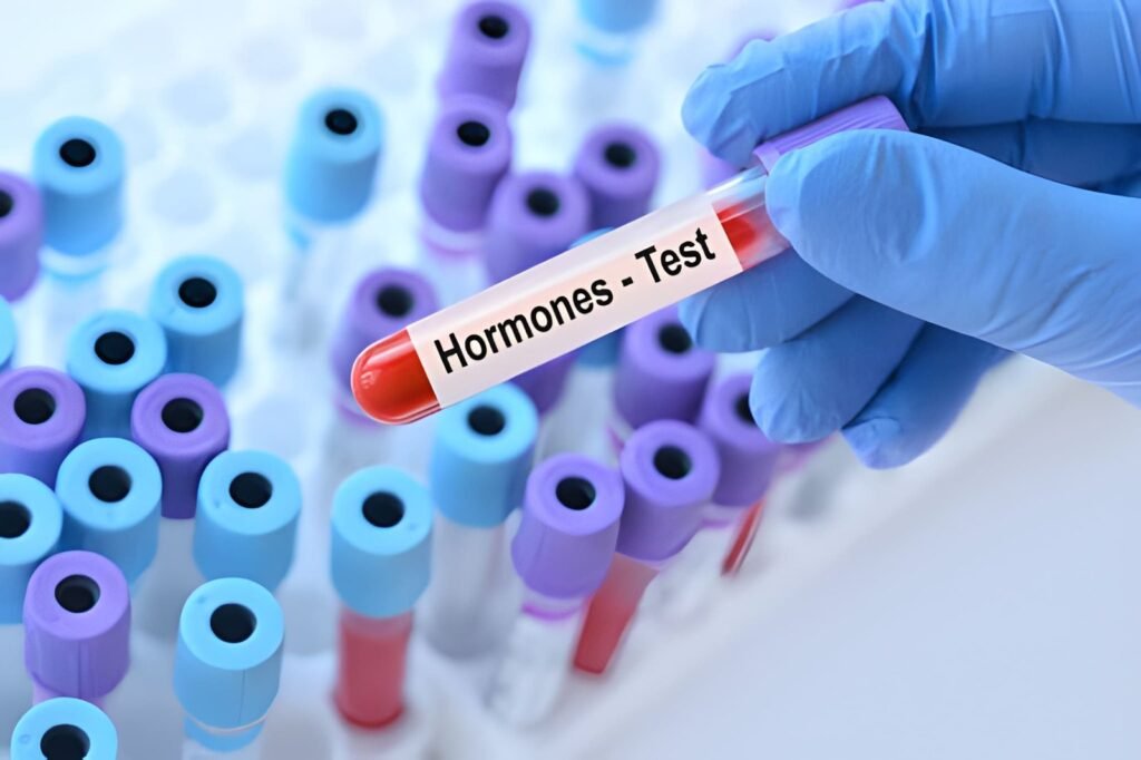hormon testleri