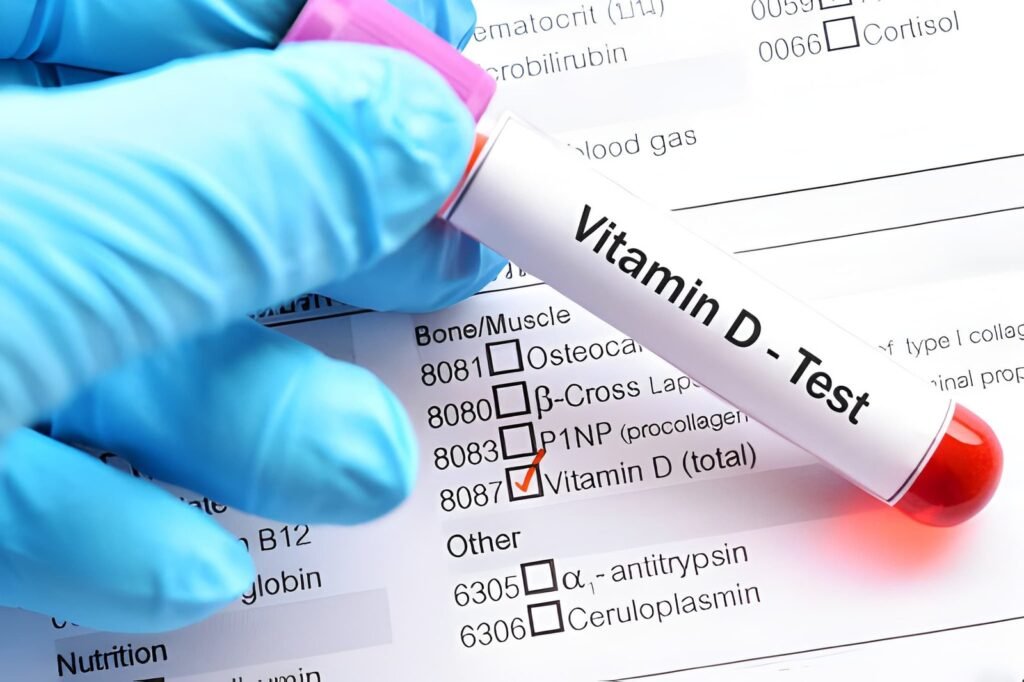 D vitamini