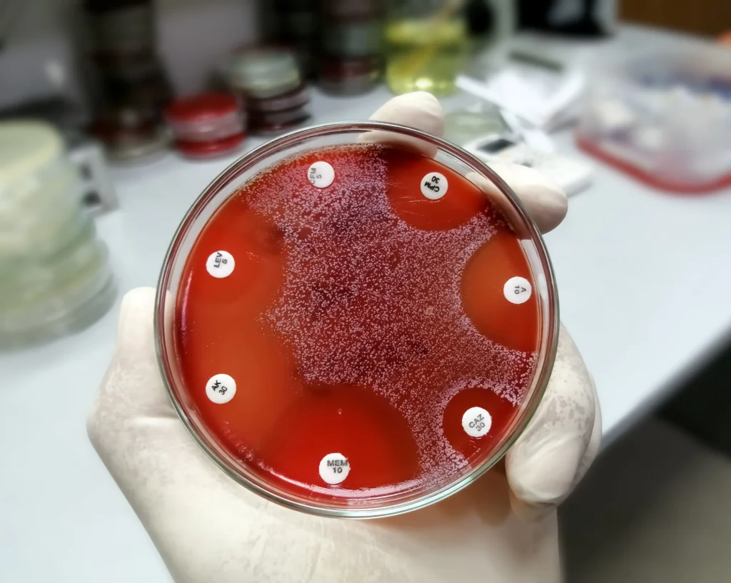 Antibiyogram Nedir Kültür Testi ve Sonuçları