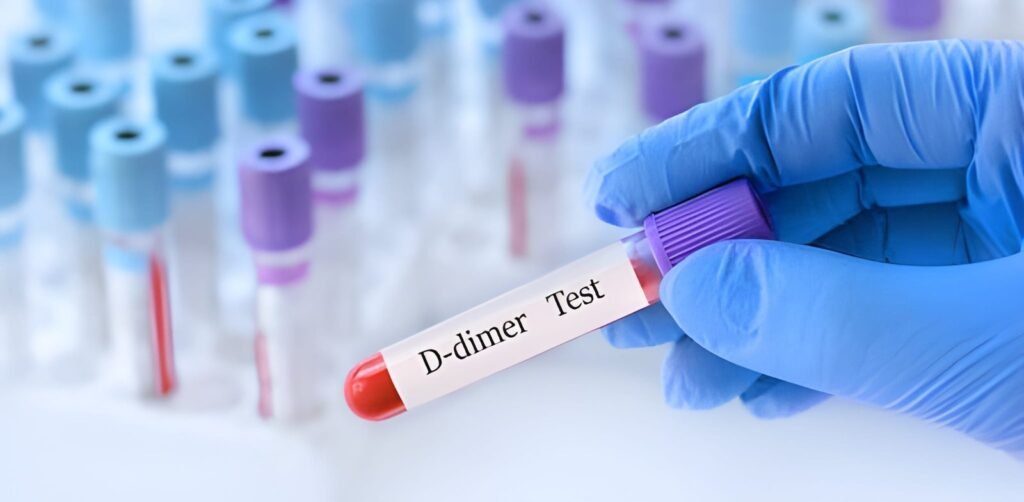 d-dimer