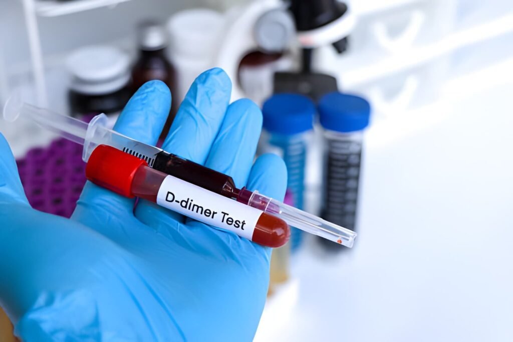 d dimer testi